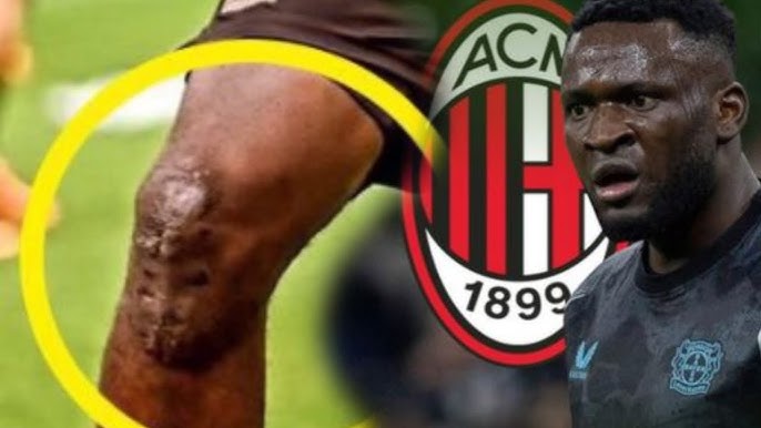 Victor Boniface Injury - Photo Credit : Final Whistle, Youtube