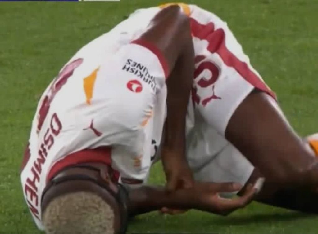 Victor Osimhen arm injury- Photo credit: Facebook