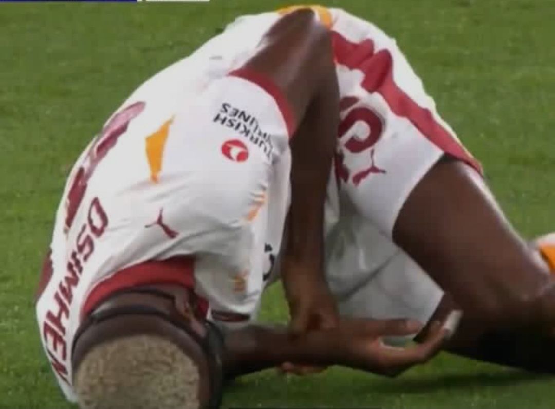 Victor Osimhen arm injury- Photo credit: Facebook