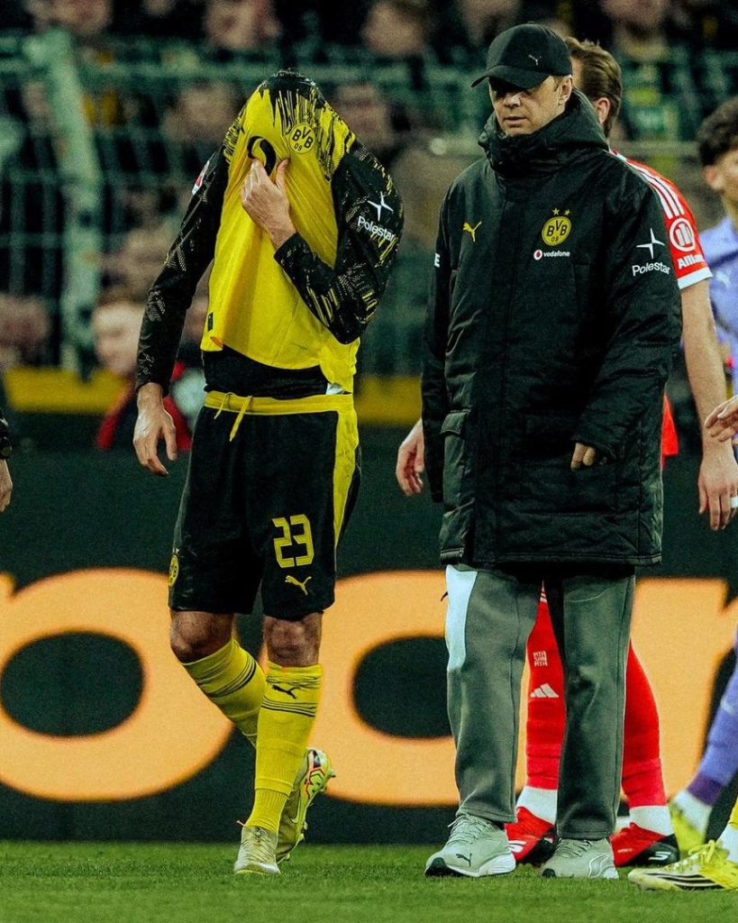 Emre Can injury (Photo credit: Dortmund via x)